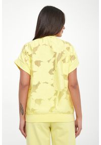 Liu Jo - Kamizelka damska żakardowa LIU JO. Materiał: żakard #5