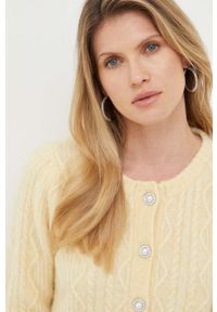 Custommade kardigan wełniany kolor żółty. Okazja: na co dzień. Kolor: żółty. Materiał: wełna. Wzór: ze splotem. Styl: casual #3